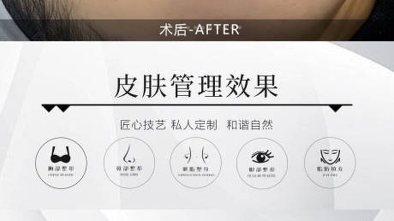瘦脸操VS面部瑜伽：揭秘两种瘦脸方式的本质区别