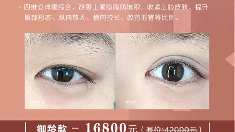 揭秘皮肤管理家用仪器：品牌排名背后的真相