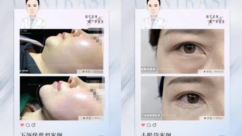 点阵激光治疗仪参数对比方法