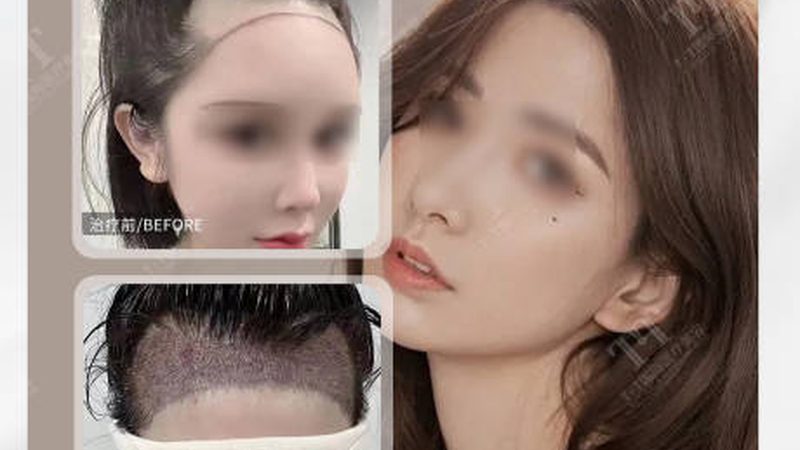 轻医美护肤哪家效果好