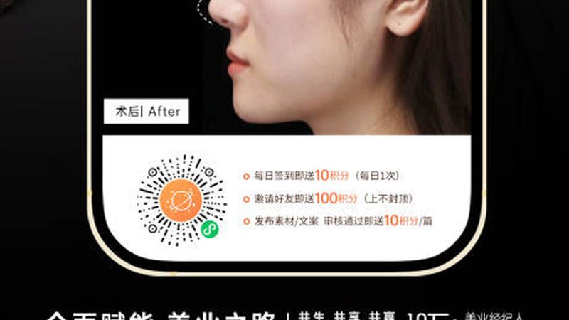 激光治疗黄褐斑：揭秘治疗流程与恢复期
