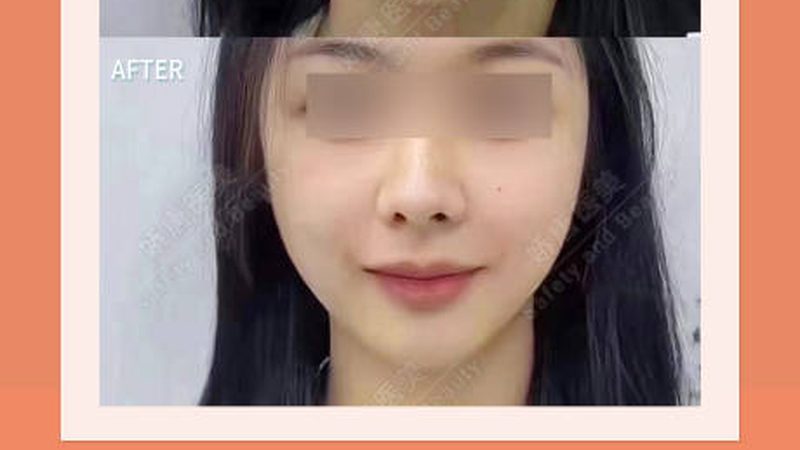 家用脱毛仪，波长多少才算合适？揭秘脱毛仪的秘密**