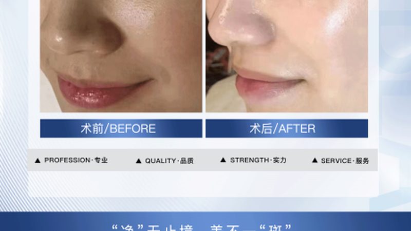 揭秘食品级玻尿酸：从原料到报价单的全方位解析