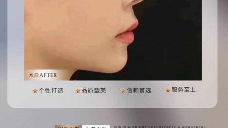皮肤管理VS皮肤科：揭秘两者差异，告别误区