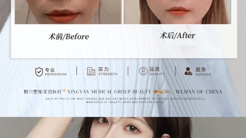 成分解析：玻尿酸的分类与作用