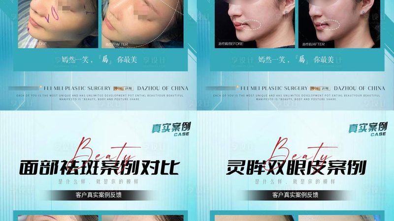 热玛吉VS线雕：揭秘两种抗衰老技术的本质区别