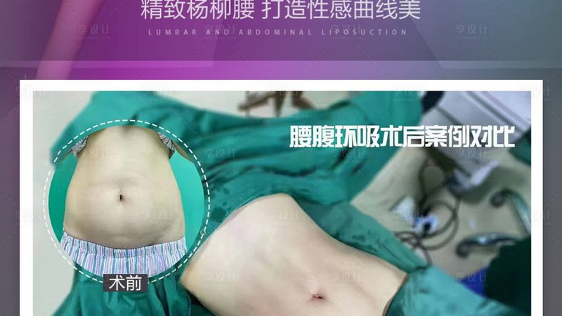 埋线提升线材，出厂价与零售价差多少的真相**