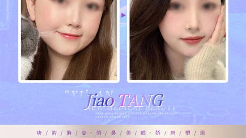 医用水光针：揭秘其原理与选购要点
