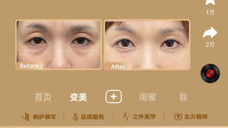 医美合同术前术后责任划分