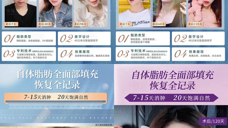 成都激光美容价格揭秘：2025年你不可不知的真相