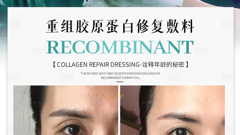 揭秘皮肤科激光治疗仪：厂家直销背后的技术秘密