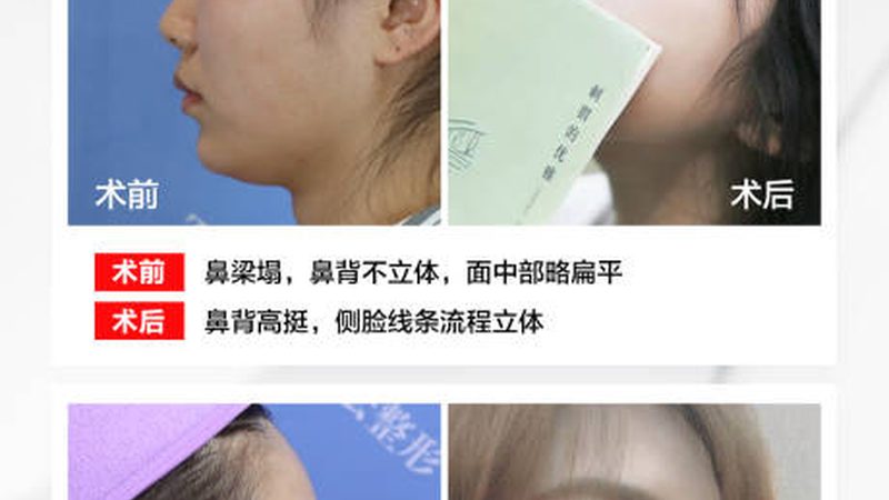 成都超声炮医院面诊，这些步骤你不可不知