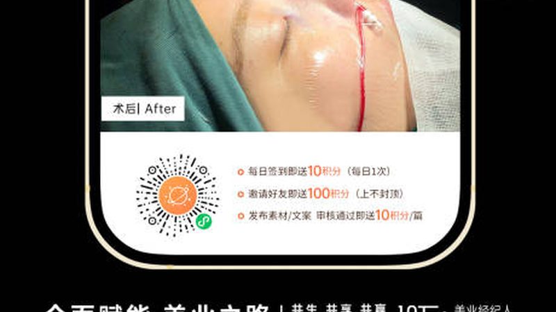 埋线提升：揭秘线体材质分类与选择